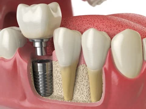 Tai Dental Surgery (Ang Mo Kio) photo 2