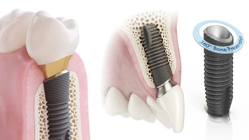 Oral Maxillofacial & Implant Clinic (OMIC) Dr Ng Chee Hon photo 1