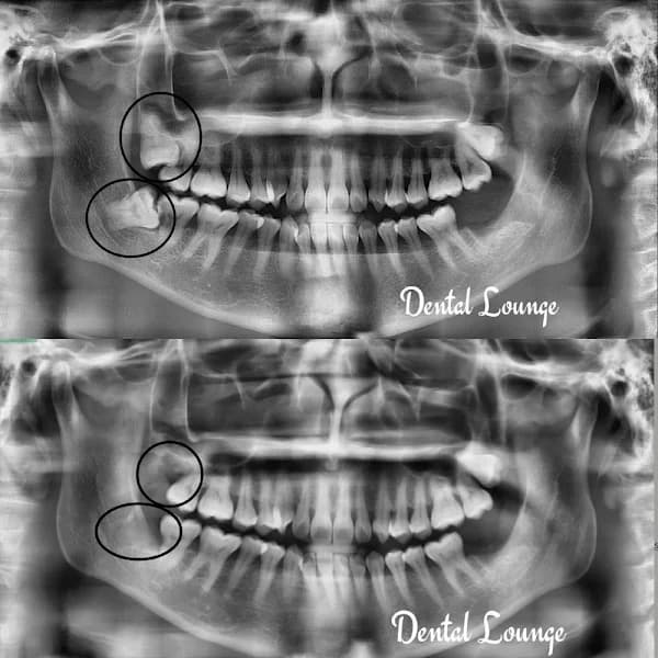 Dental Lounge (Choa Chu Kang) – formerly Quek and Me Dental Surgery photo 2