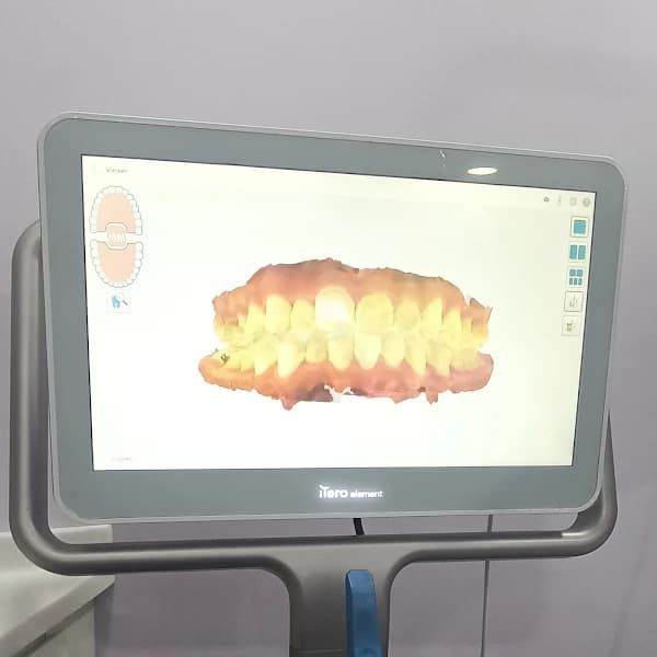 Fusion Dental photo 1