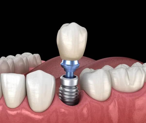 TWC Implant & Dental Center photo 4