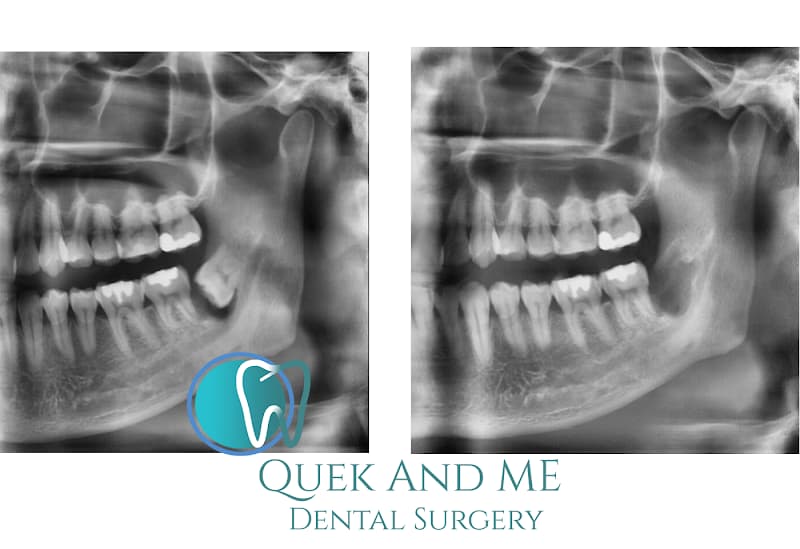 Dental Lounge (Choa Chu Kang) – formerly Quek and Me Dental Surgery photo 4