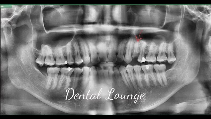 Dental Lounge (Choa Chu Kang) – formerly Quek and Me Dental Surgery photo 3