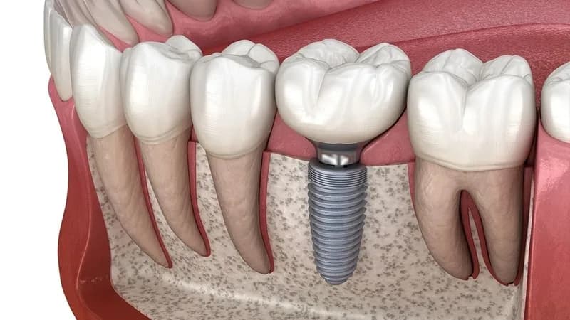 Key Dental clinic